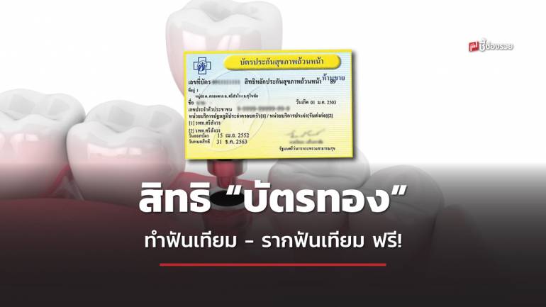 “โครงการฟันเทียม รากฟันเทียม เฉลิมพระเกียรติ” ฟรี เฉพาะสิทธิบัตรทอง